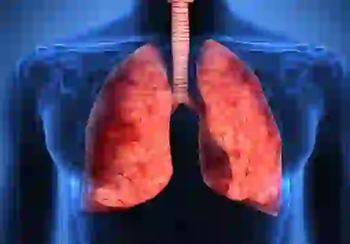 Combatir la Fibrosis Pulmonar
