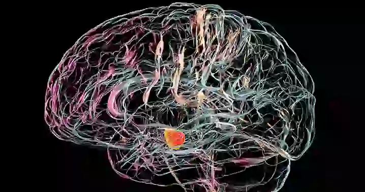 Enfermedad de Parkinson: Una Visión Integral 4 Screenshot 2 5