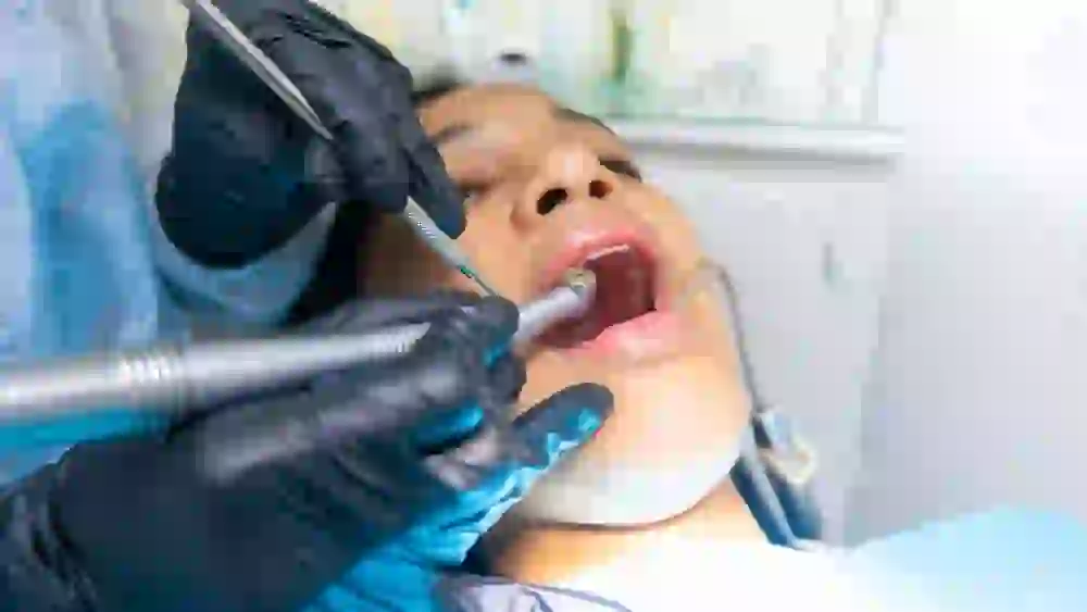 Tipos de Turbinas Dentales y Servicio de Reparación Especializada con Garantía en Soltec Electrónica 1 Reparación Turbinas Dentales