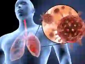 Prevención de enfermedades respiratorias: Guía para una vida saludable