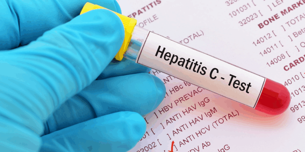 Salud recuerda la importancia de prevenir las hepatitis víricas con prácticas seguras 3 Salud recuerda la importancia de prevenir las hepatitis víricas con prácticas seguras