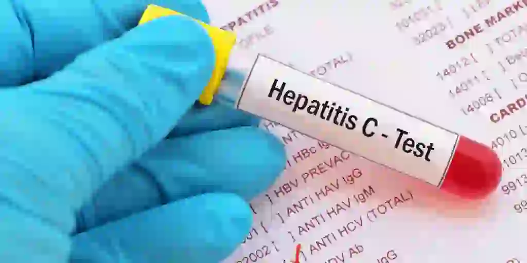 Salud recuerda la importancia de prevenir las hepatitis víricas con prácticas seguras 3 Salud recuerda la importancia de prevenir las hepatitis víricas con prácticas seguras