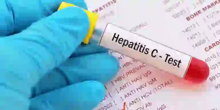 Salud recuerda la importancia de prevenir las hepatitis víricas con prácticas seguras