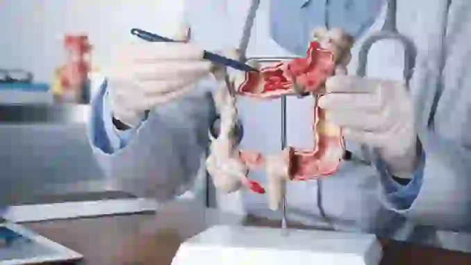 La Terapia Triple en Líneas Tardías: Nuevos Beneficios en el Tratamiento del Cáncer Colorrectal