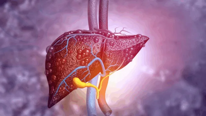CNNM4: Nueva Esperanza contra el Cáncer de Hígado Agresivo