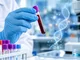 Biomarcadores en sangre: cómo ayudan a detectar posibles señales de cáncer